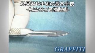 泌尿器科手術の基本手技 -根治的右腎摘除術- 泌尿器科手術の基本手技 -根治的右腎摘除術-